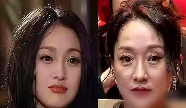 杨幂赵露思们那张绷不住的脸，跟周迅蔡少芬们眼角的真褶子一比，谁在裸泳，一目了然。