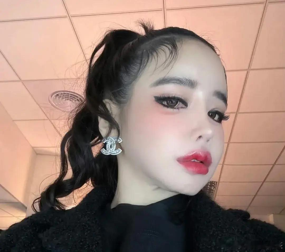 坚持称自己没整容 而是激素导致浮肿的朴春 ​​​