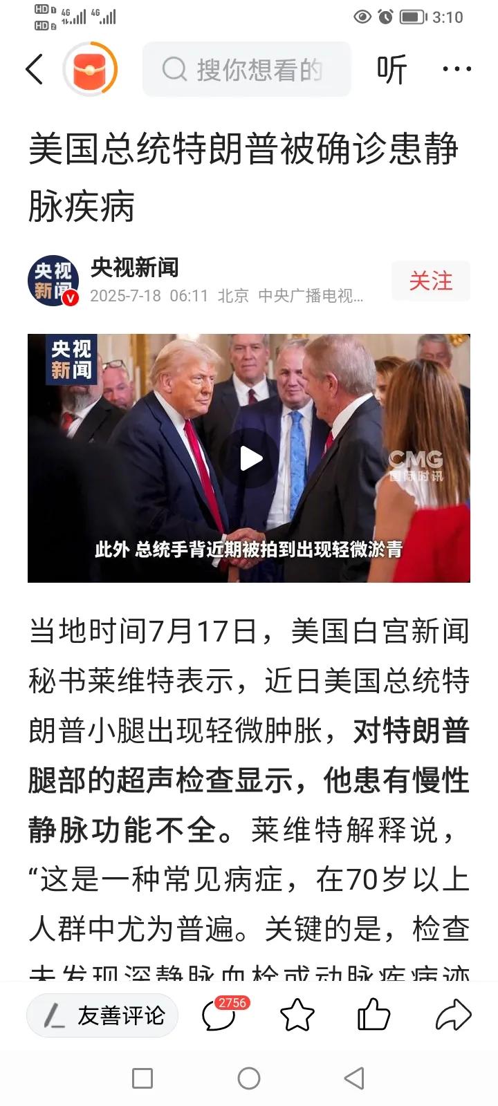 美国当地时间7月17日，总统发言秘书称特朗普患有慢性静脉功能不全！虽然这是年龄偏