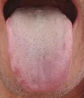 如何大幅度降低精关阈值？





有不少粉丝朋友年纪轻轻就出现了一触即溃，望门