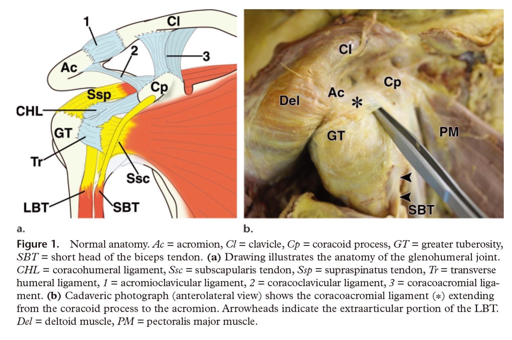 肱二头肌Pulley结构。