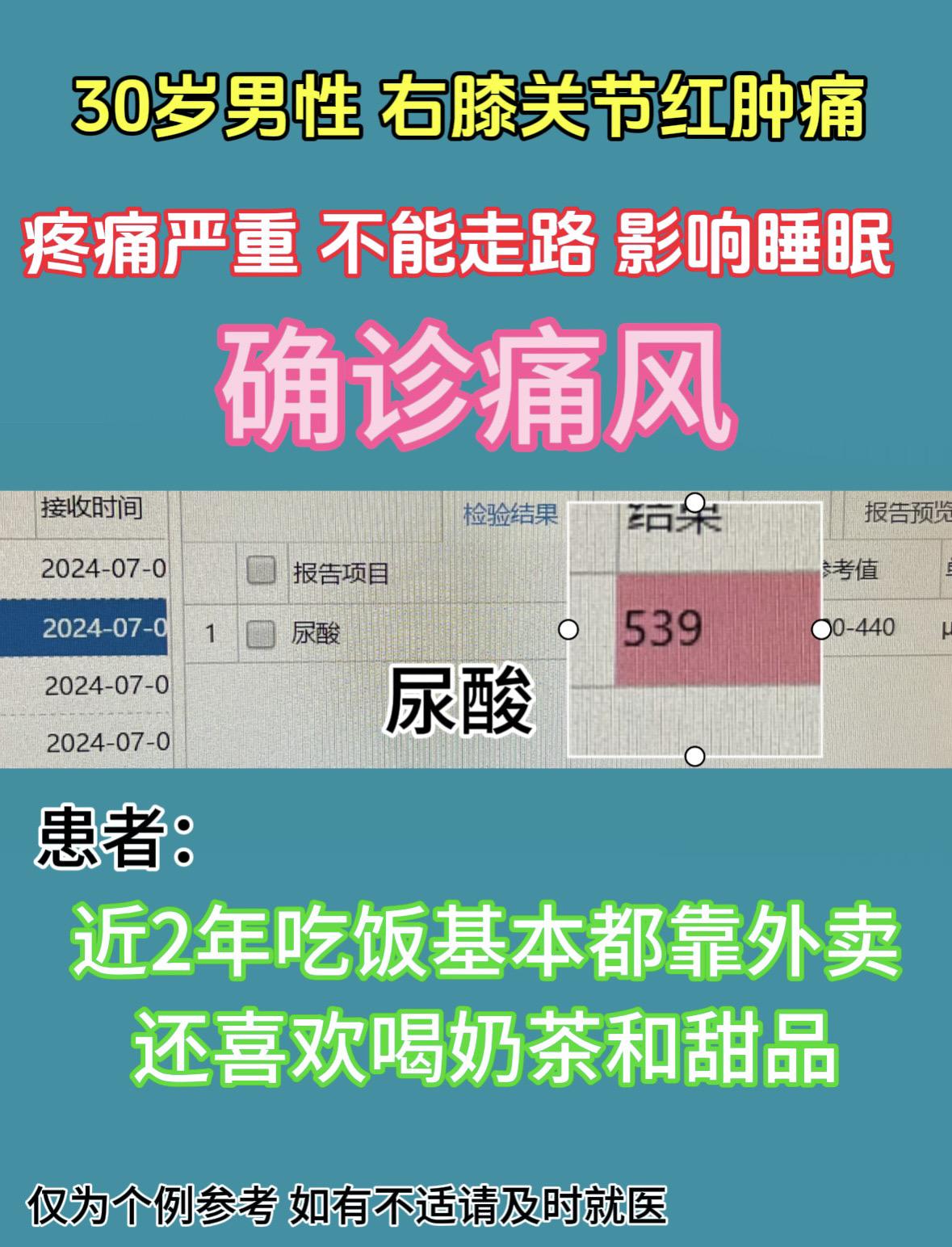 30岁男性，右膝关节红肿痛2天，疼痛严重，不能行走，影响睡眠。没有外伤...