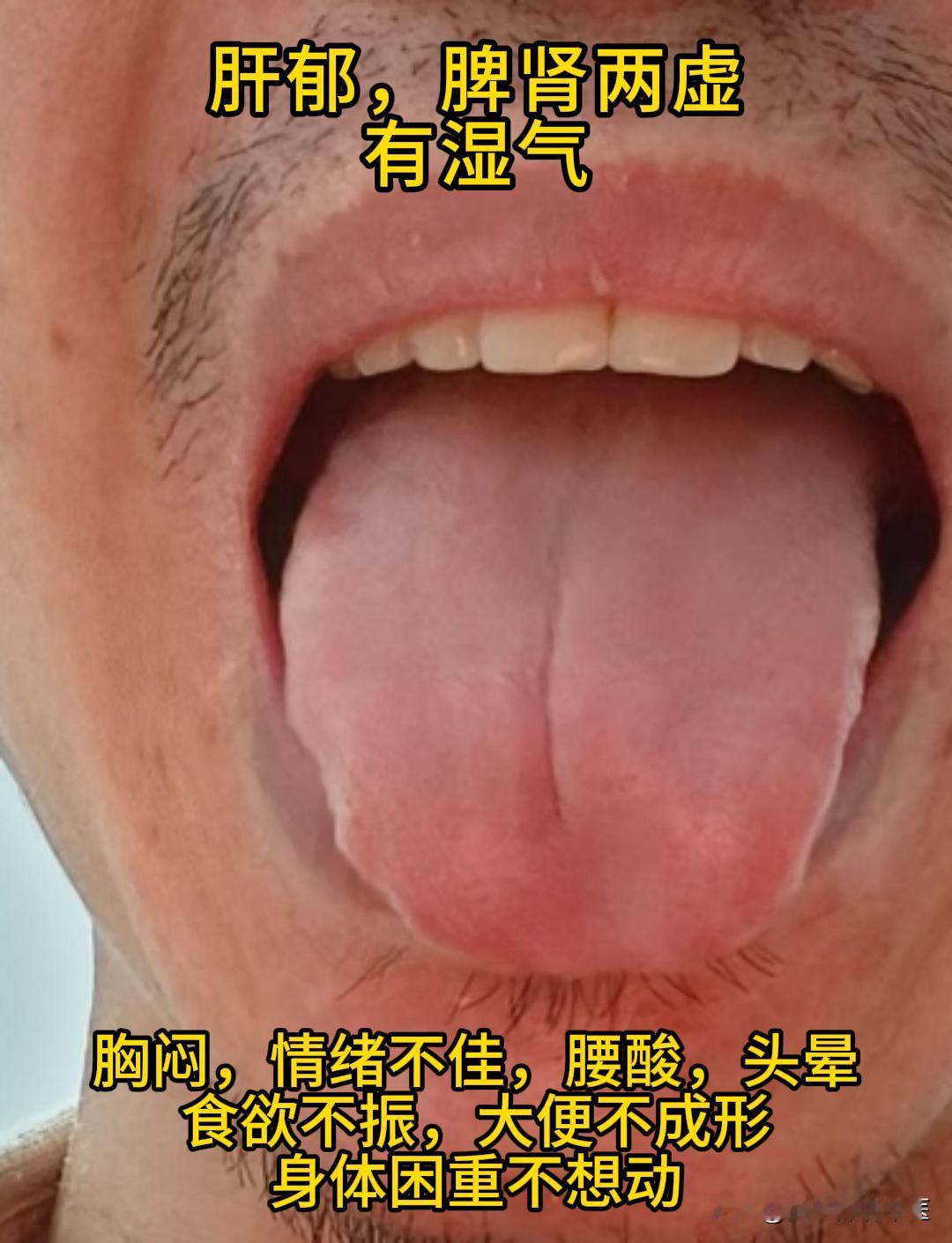 今日有时间，可以帮大家看看舌象。

有需要的，尽管把你的舌象照片发过来吧！越早发