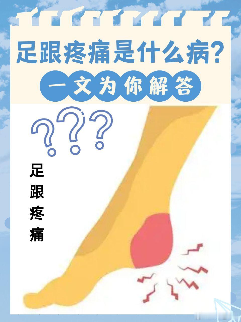 一首治疗“骨刺型”跟骨疼痛的秘方 足跟痛，医学上常称为“跟骨骨刺”或“足跟骨质增