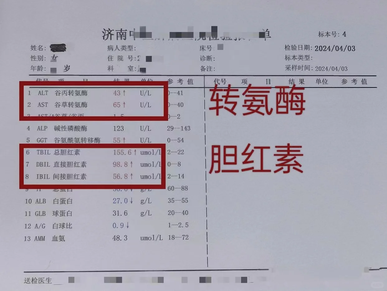 肝功能指标升升降降，最害怕的是这一高一低