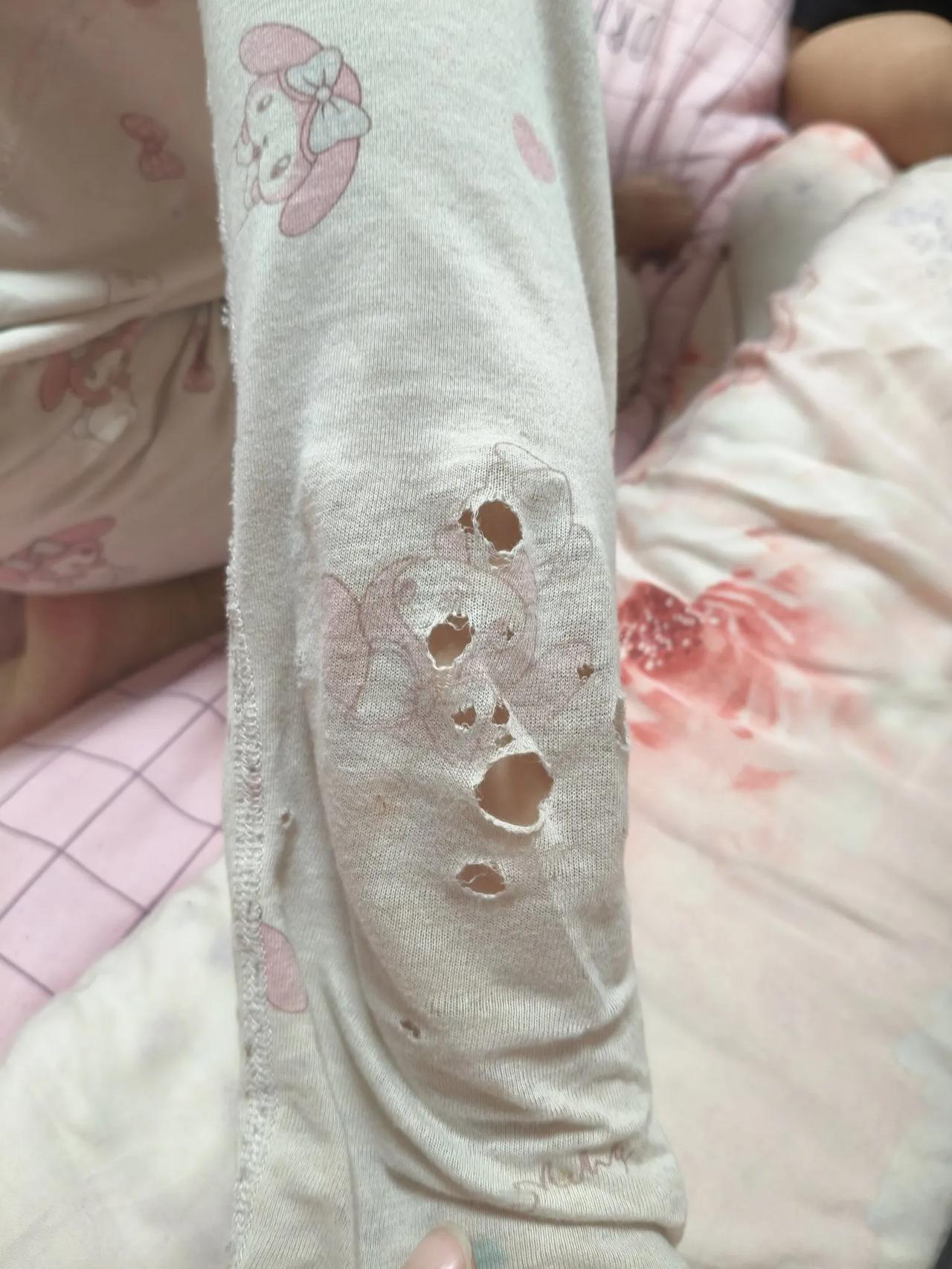 哈哈  闺女的睡衣穿了3年了
真是又小又破
手肘那个地方都磨得破了好几个窟窿
给