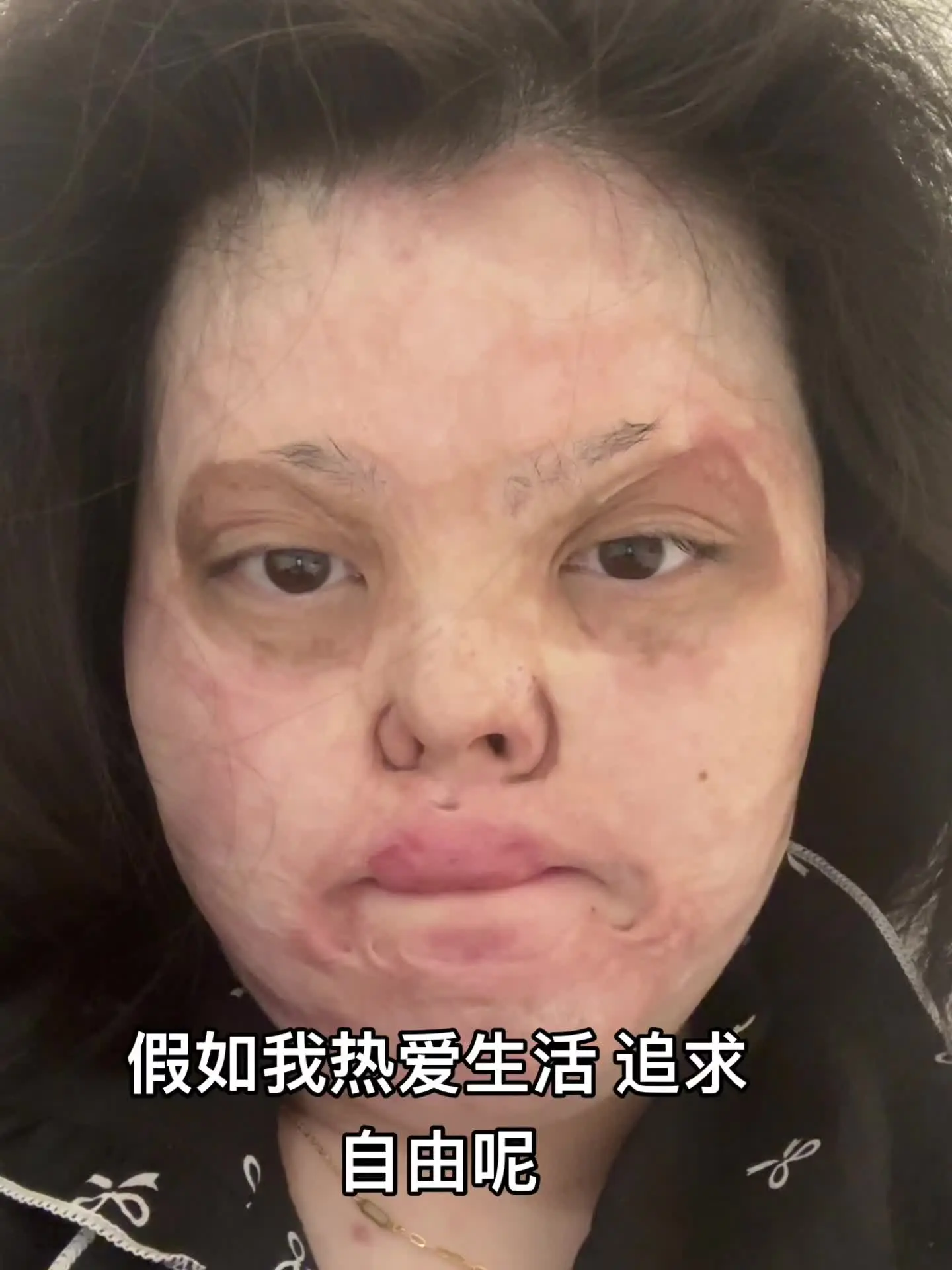 当我不再局限于自己