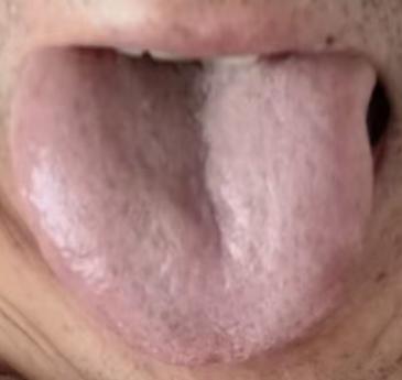 宗筋失充中途疲软，辨证分型调理方法






过往伤精多年，如今毫无行事能力，