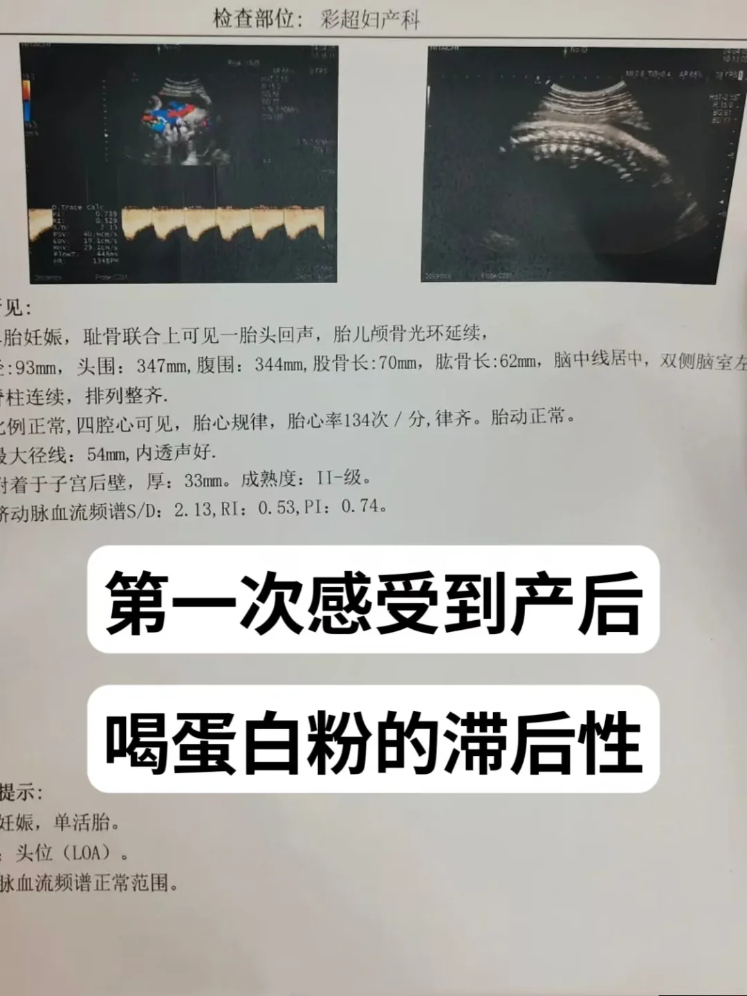 第一次感受到产后喝蛋白粉的滞后性❗