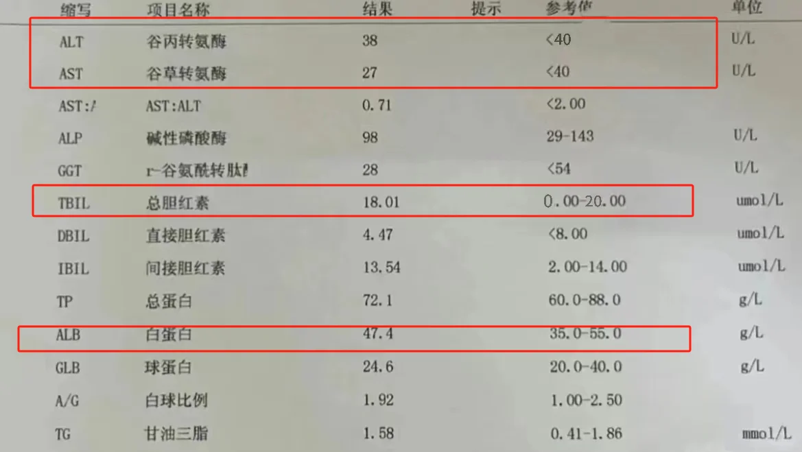 肝功能指标怎么看？警惕这4项 1、白蛋白低于30，肝病朋友要小心肝硬化...