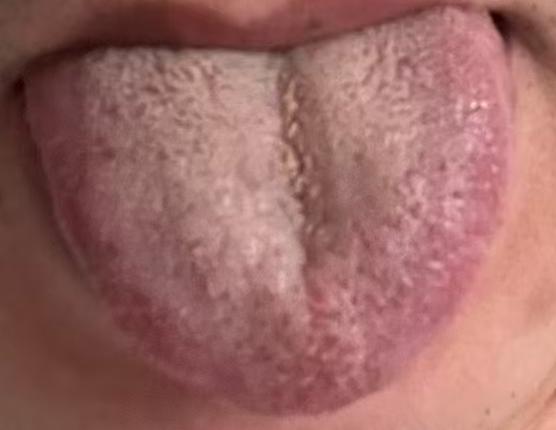 肾精亏虚影响身体状态，浅谈固本填精的辨证养护方法






不少男士朋友们到了