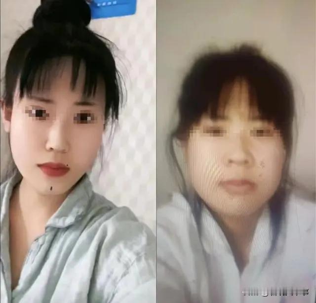 离奇！上海，一位24岁的花季少女花210000元去做整形，不料，在被整形医院要求