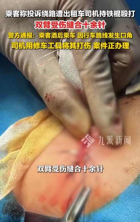 太嚣张了！山西太原，男子打车回家，司机见他喝了酒肯定不省人事，就想故意绕路，没想
