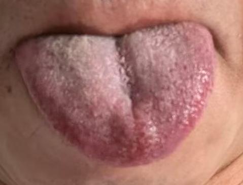 宗筋濡养不足，多是虚实夹杂体质所致






假如出现了房事能力低下的问题，这