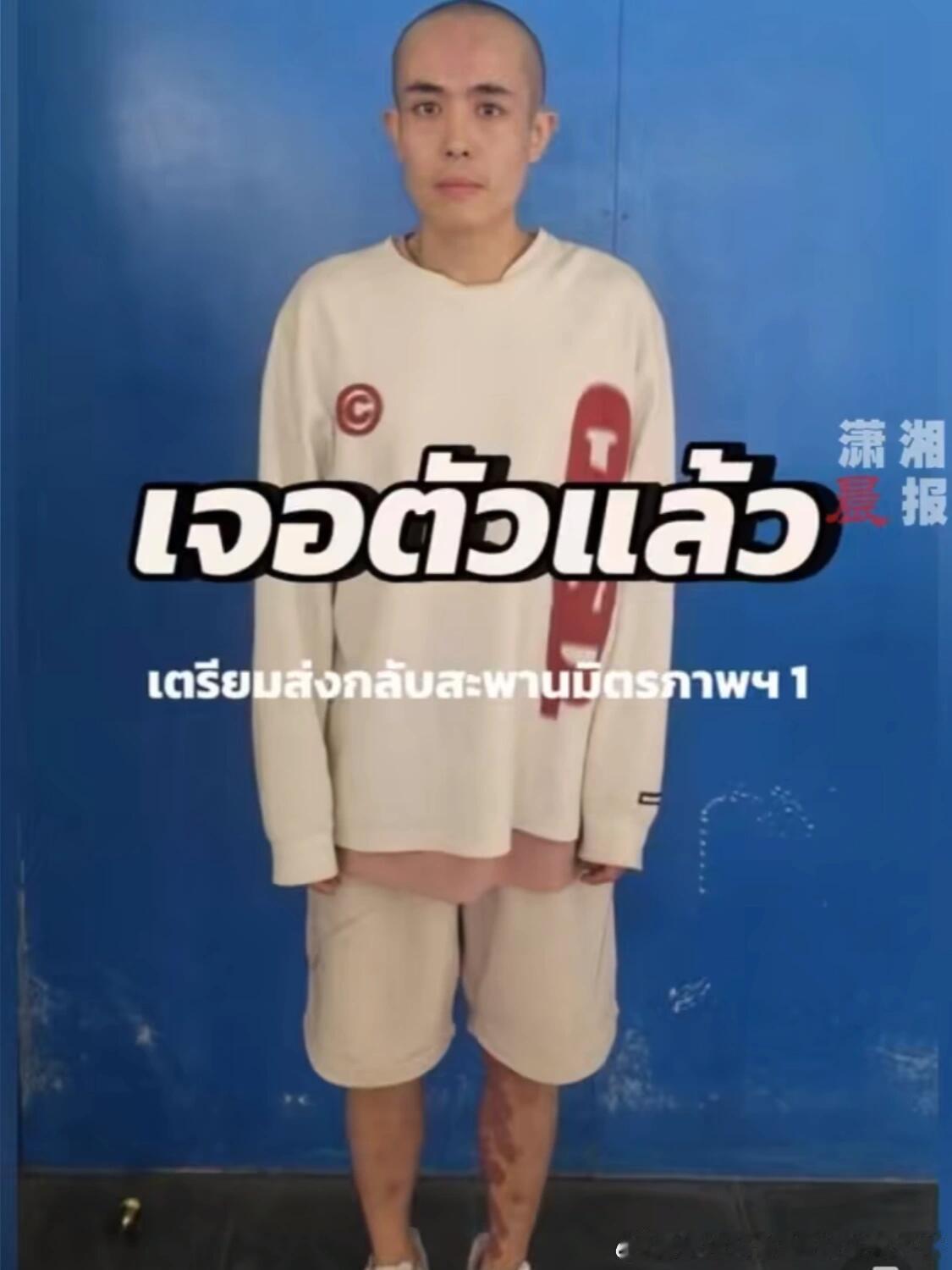 星星疑被剃去头发腿上有红斑 这么吓人，才三天啊，头发被剃了，腿上那是怎么造成的？