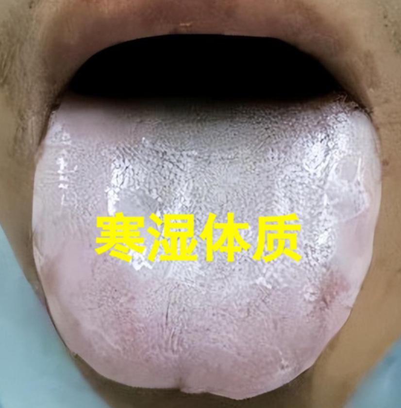 湿气总缠着不放？痰湿，寒湿，湿热，很多人傻傻分不清，中医一次性给你讲明白！

1