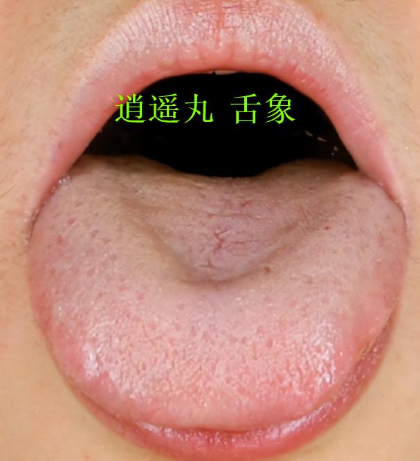 这两颗小药丸，就是逍遥丸的升级版！不仅疏肝，还能活血化瘀，化掉一身淤血！[给力]