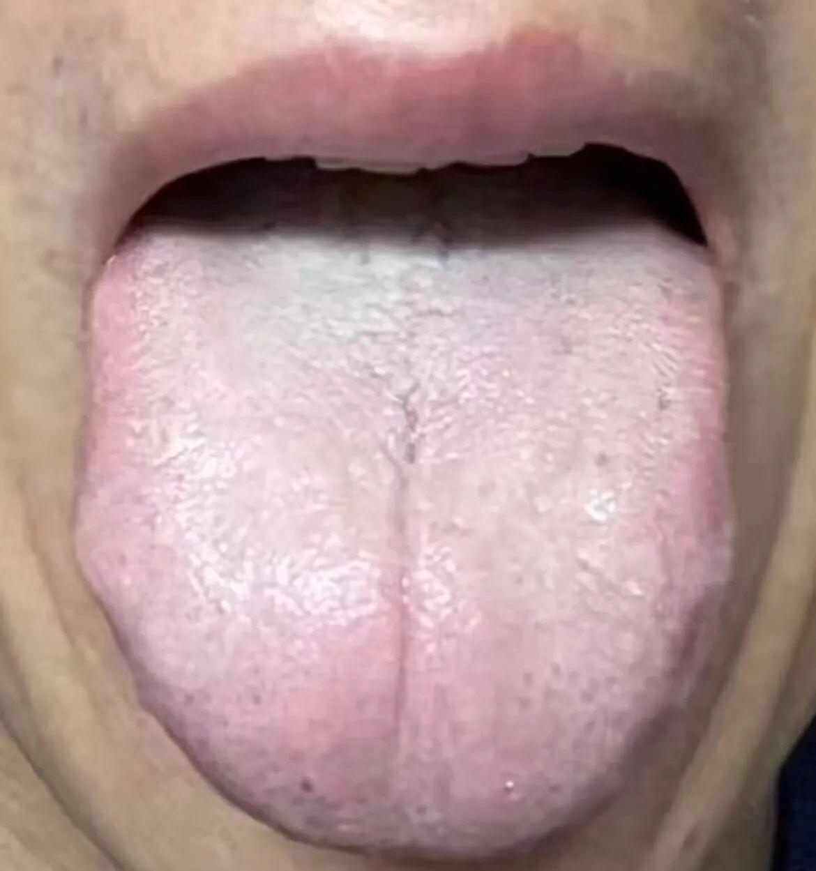 脾虚困扰？不妨尝试蒸苹果这一自然疗法。
我们周围有许多人面临着脾虚和湿气重的问题