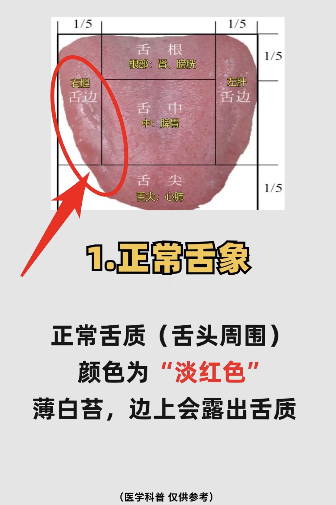人体8大体质，自己对照舌象，看一看是哪一种？

#健康##中医##舌诊#