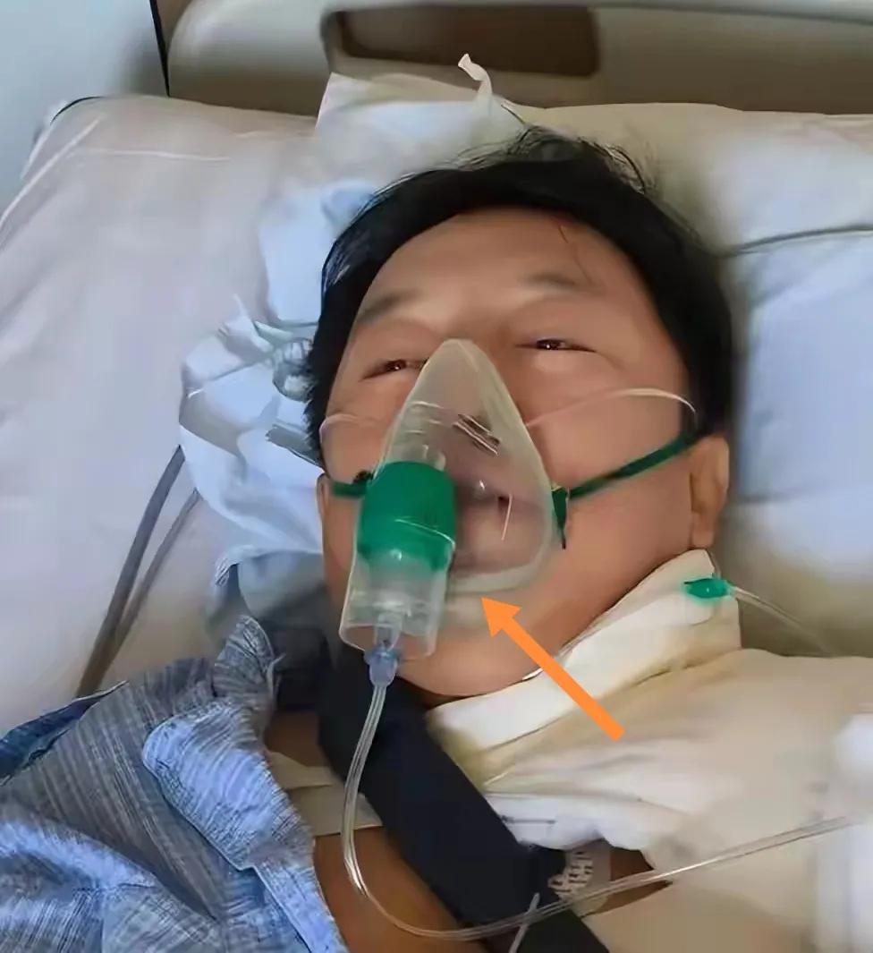 电影明星黄渤住院躺在病床上戴氧气罩。
