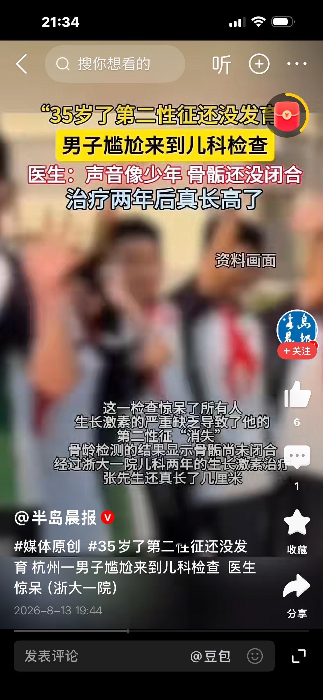 难以置信！35岁男子第二性征迟迟未发育，尴尬就诊儿科，治疗两年成功长高

杭州张