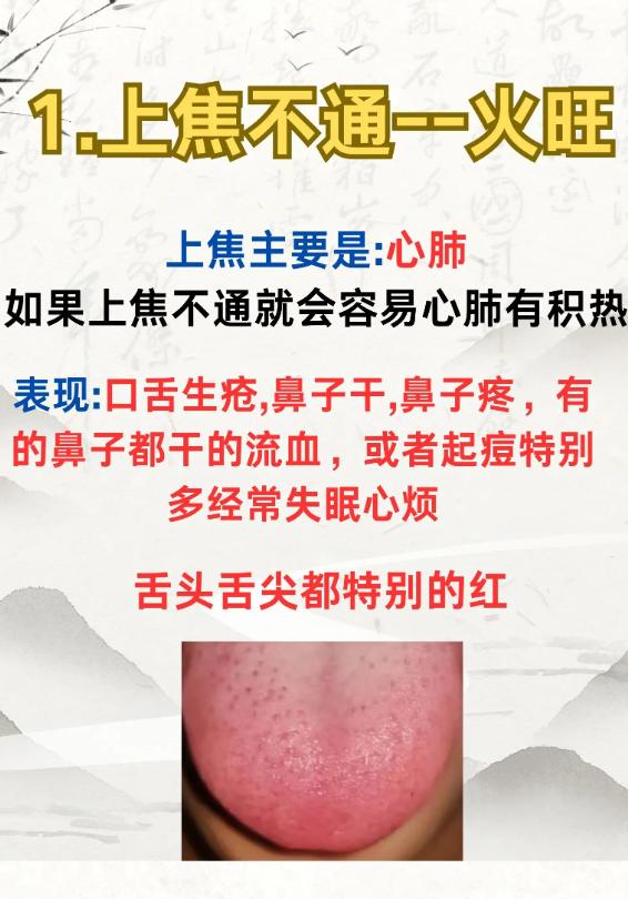 上、中、下焦不通，身体会有哪些信号？