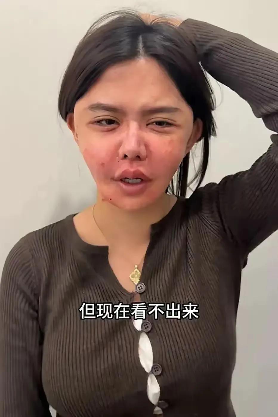 韩安冉真的要整成怪物了，可怕，整容上瘾，只会害了自己，醒醒吧，别再糟蹋自己肉体了