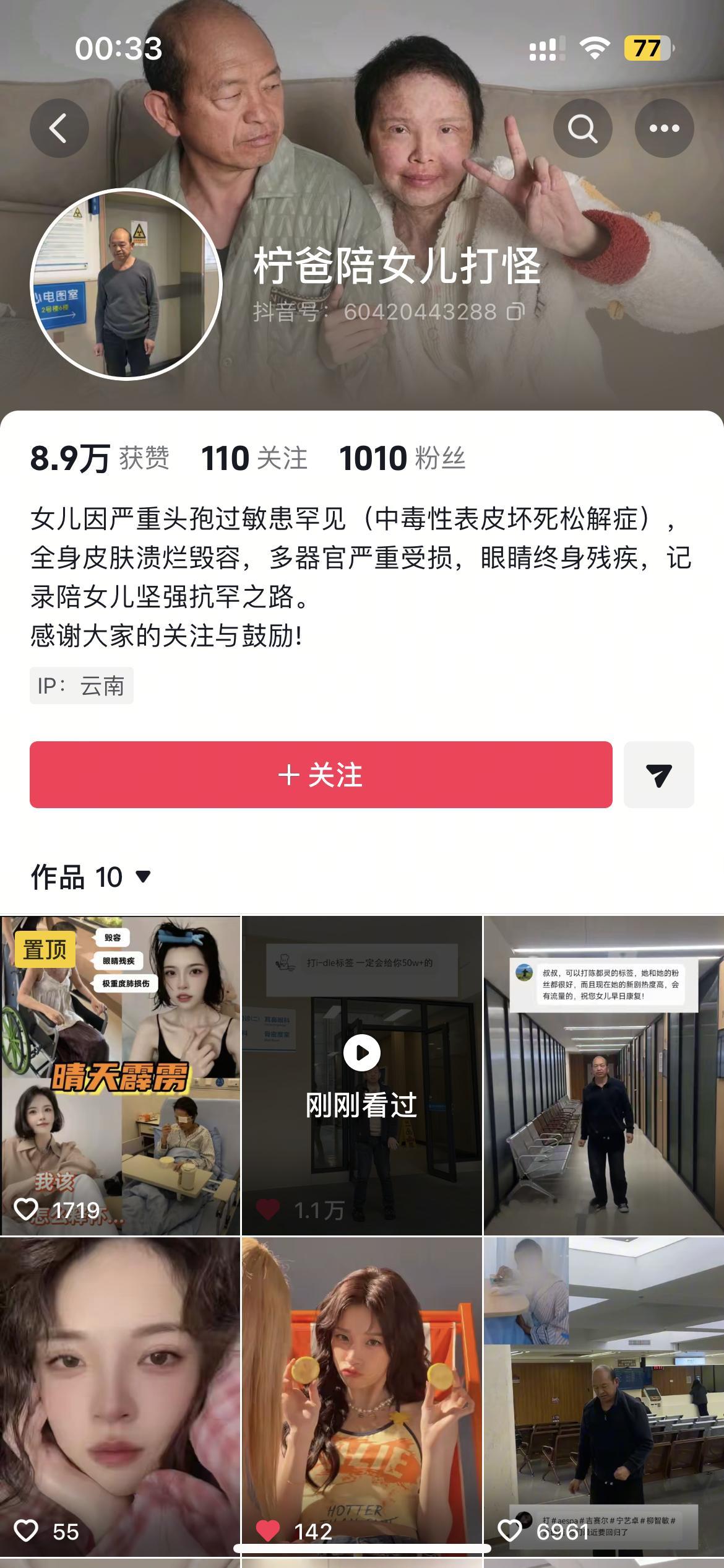 抖音刷到的 虽然不知道这样会不会给你带来收益 但还是给你扩散宣传一下 希望早日战