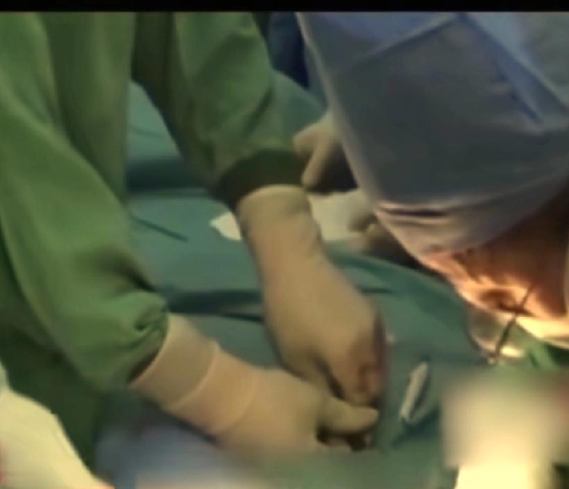 工地惊魂！
42岁钢筋工关键部位被切断，
妻子一个关键举动保住了整个家的希望。 