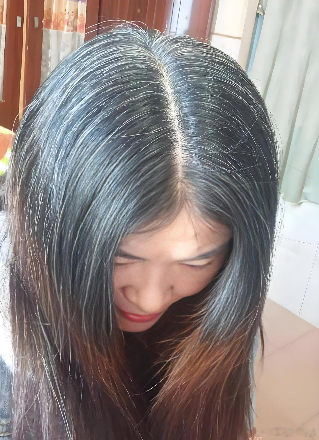 1.头发两鬓白--肝功能下降2.头发前面白--脾功能下降3.头发后脑勺白--肾功