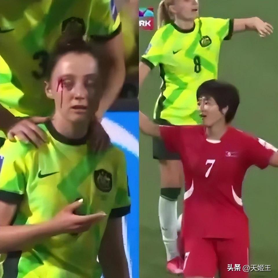 女足亚洲杯太让人失望了！朝鲜女足暴力伤人，对手血流不止，裁判只给黄牌，亚足联全程