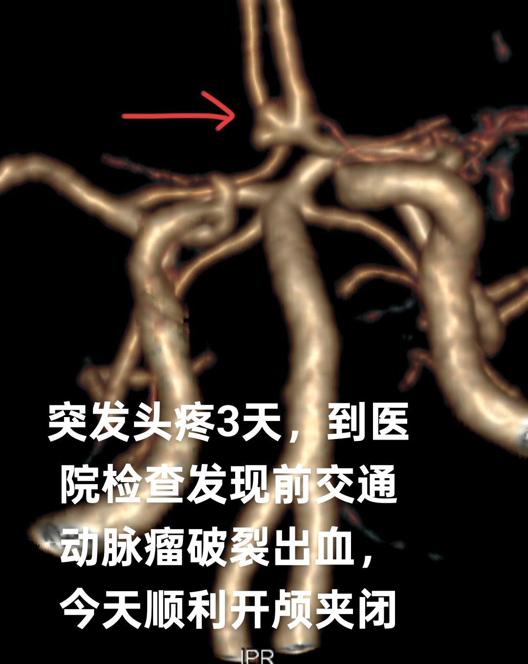 健康