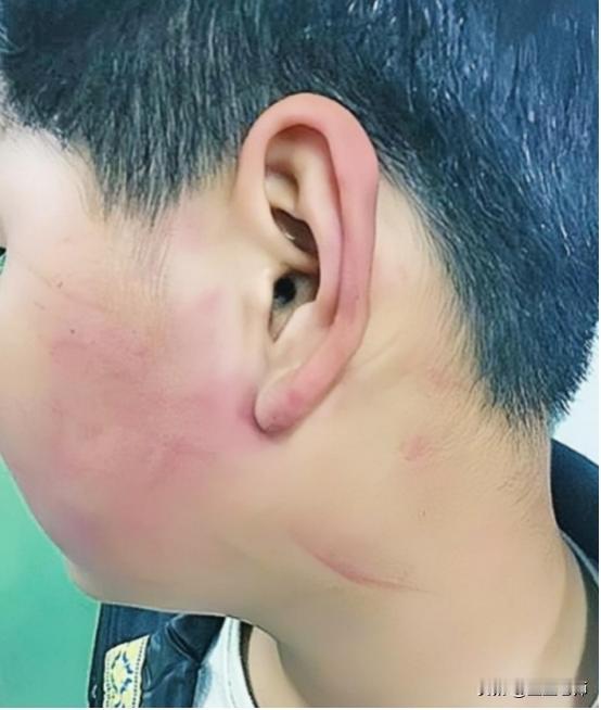 2019年，四川一名校长，因学生调皮，扇了他几巴掌，被孩子母亲逼着赔礼道歉。不料