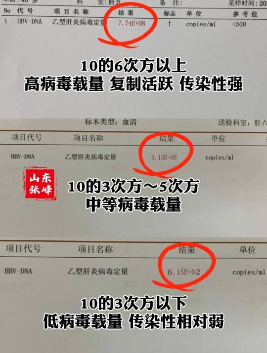乙肝病毒量怎么看？