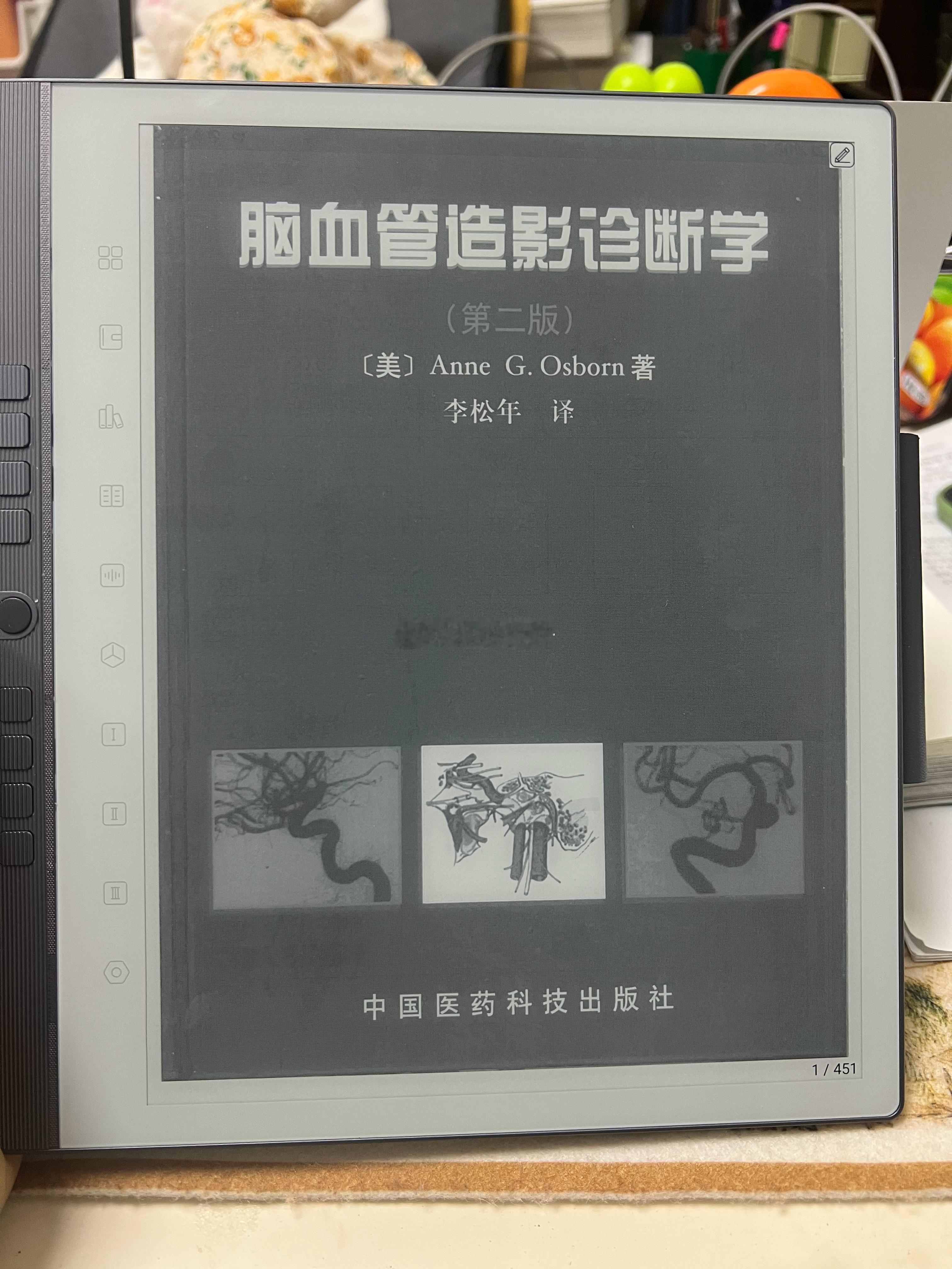 脑病科的手术主要是介入治疗，如果打算上手术，那这本《脑血管造影诊断学》值得一读，