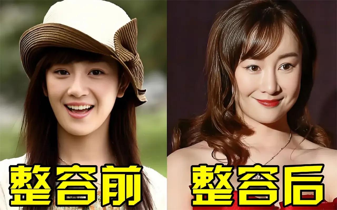 张檬的整容就是毁容，我心目中的夏天美一去不复返啦。想整容的一定要三思而后行。