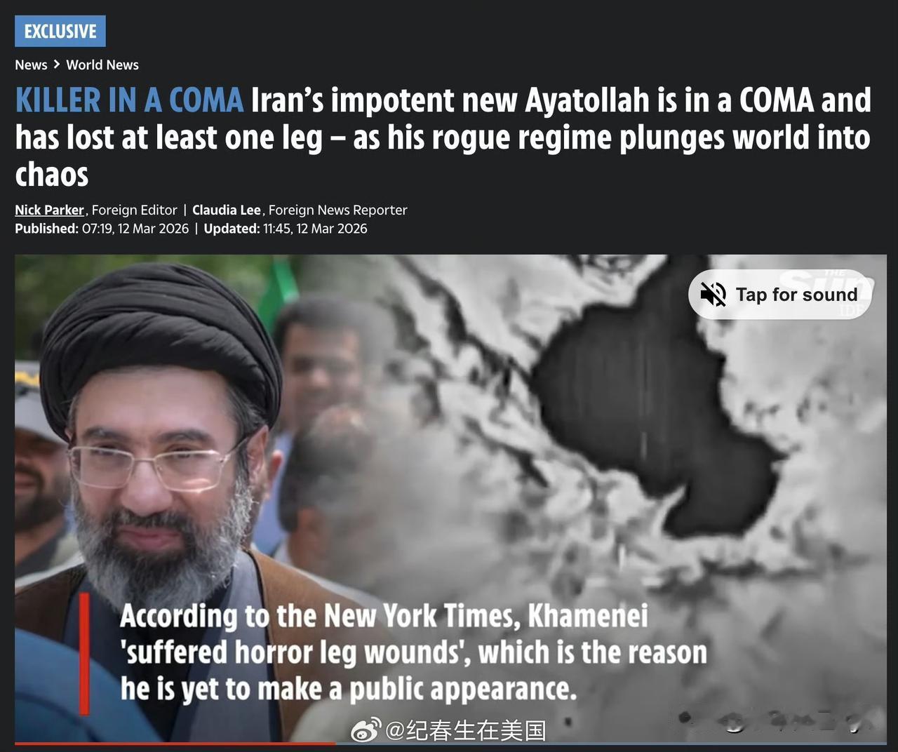 <太阳报>：新任最高领袖 Mojtaba已陷入昏迷，至少失去了一条腿，并且腹部或