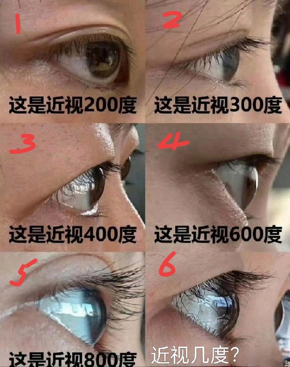 大家猜一下6号眼睛近视几度？ ​​​