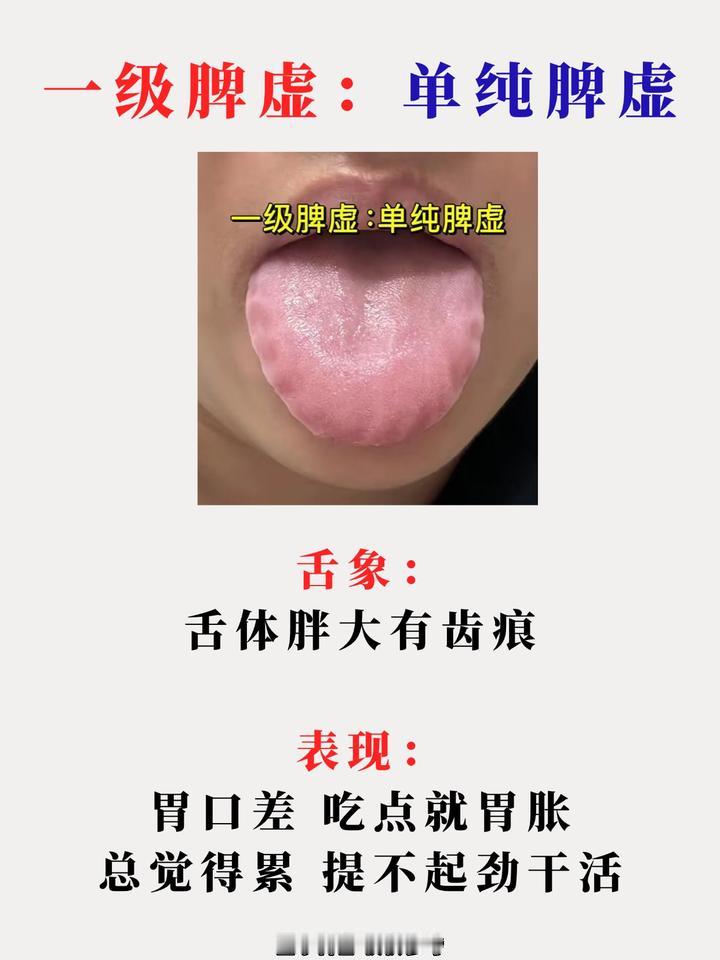 浑身毛病查不出原因？多半是脾虚！5个等级自测法，超过第2级要当心了！赶紧对照
今