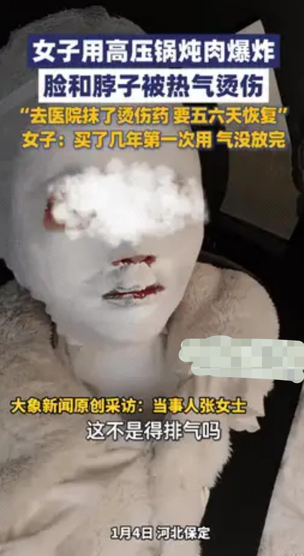 保定女子首次用高压锅，

一个动作让热浪扑面！

近日这起事故给所有人敲响警钟。