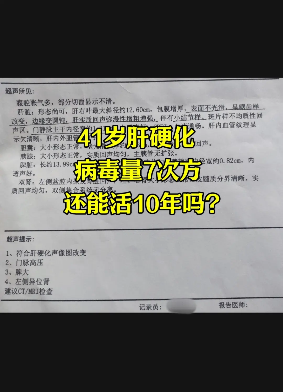 41岁肝硬化病毒量7次方还能活10年吗？ 上午来了位济宁患者，一推开门...