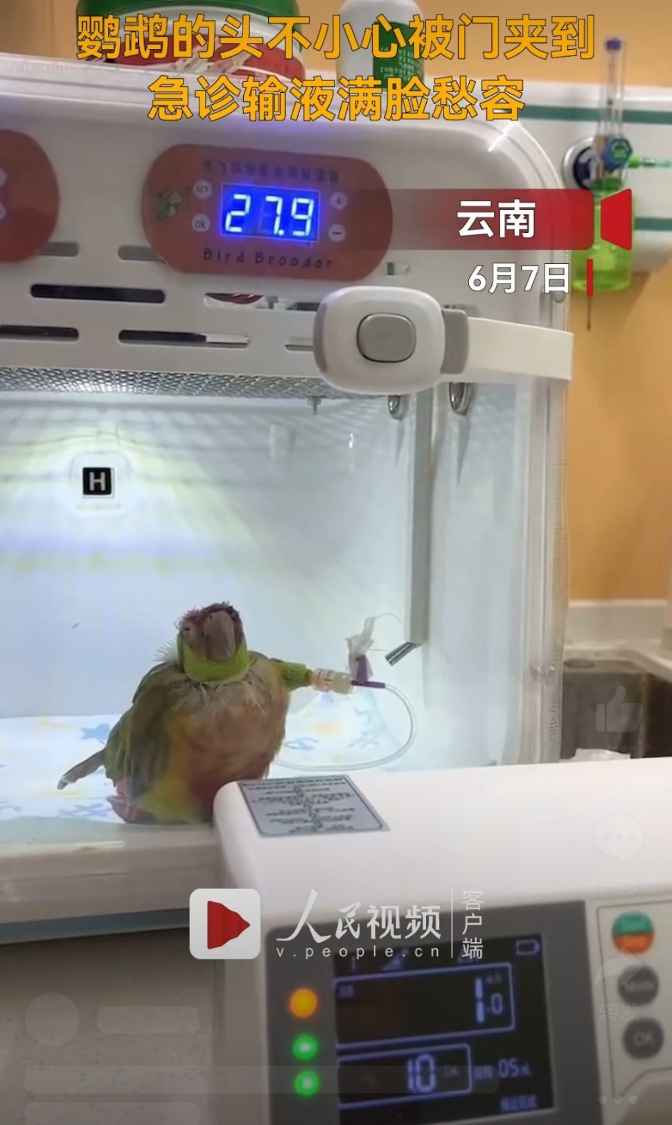 #鹦鹉被门夹到鼻青脸肿急诊输液#动物医学：鹦鹉输液，金刚鹦鹉换钛合金喙，大嘴鸟换