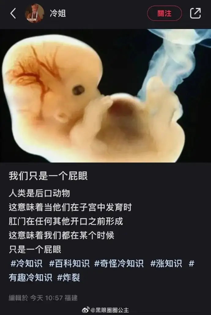 <img src=