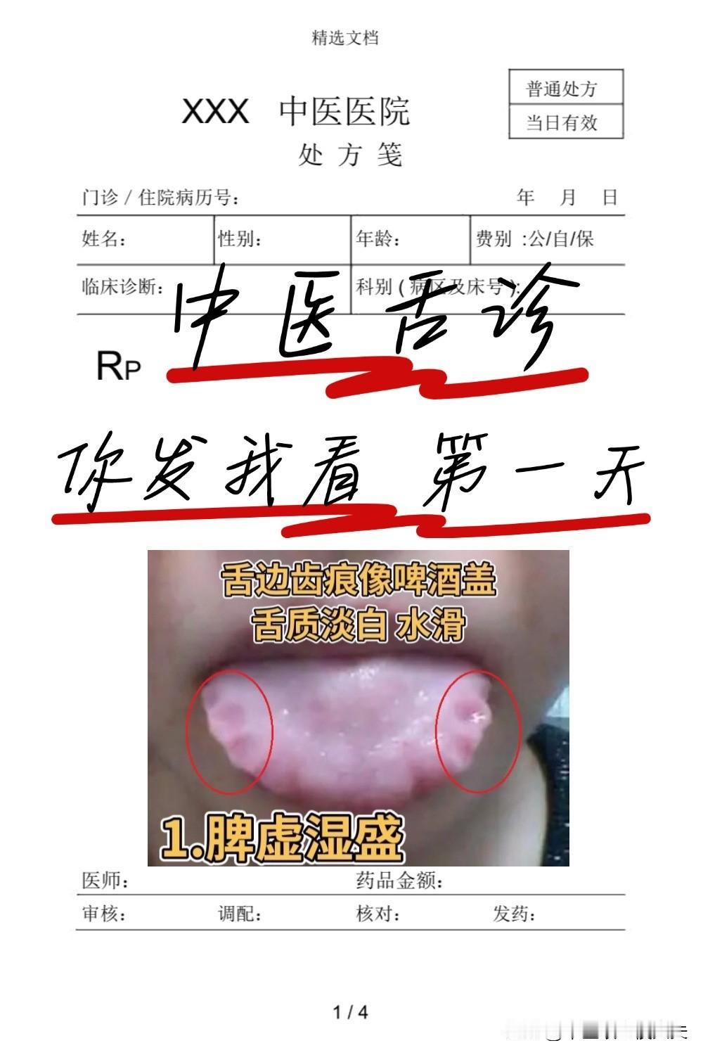 今天继续挑战给大家看舌头——第一天，，你发我看，立马出结果！

注意：无美颜，无