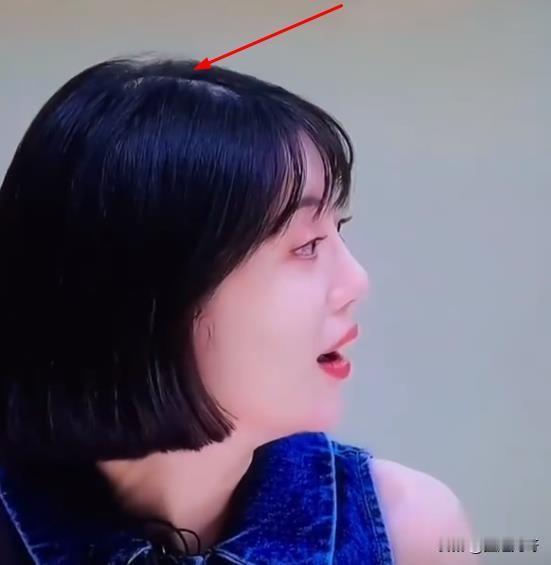 哇哈~原来明星也会秃顶，李溪芮这个发缝，瞬间治好了我的发量焦虑。