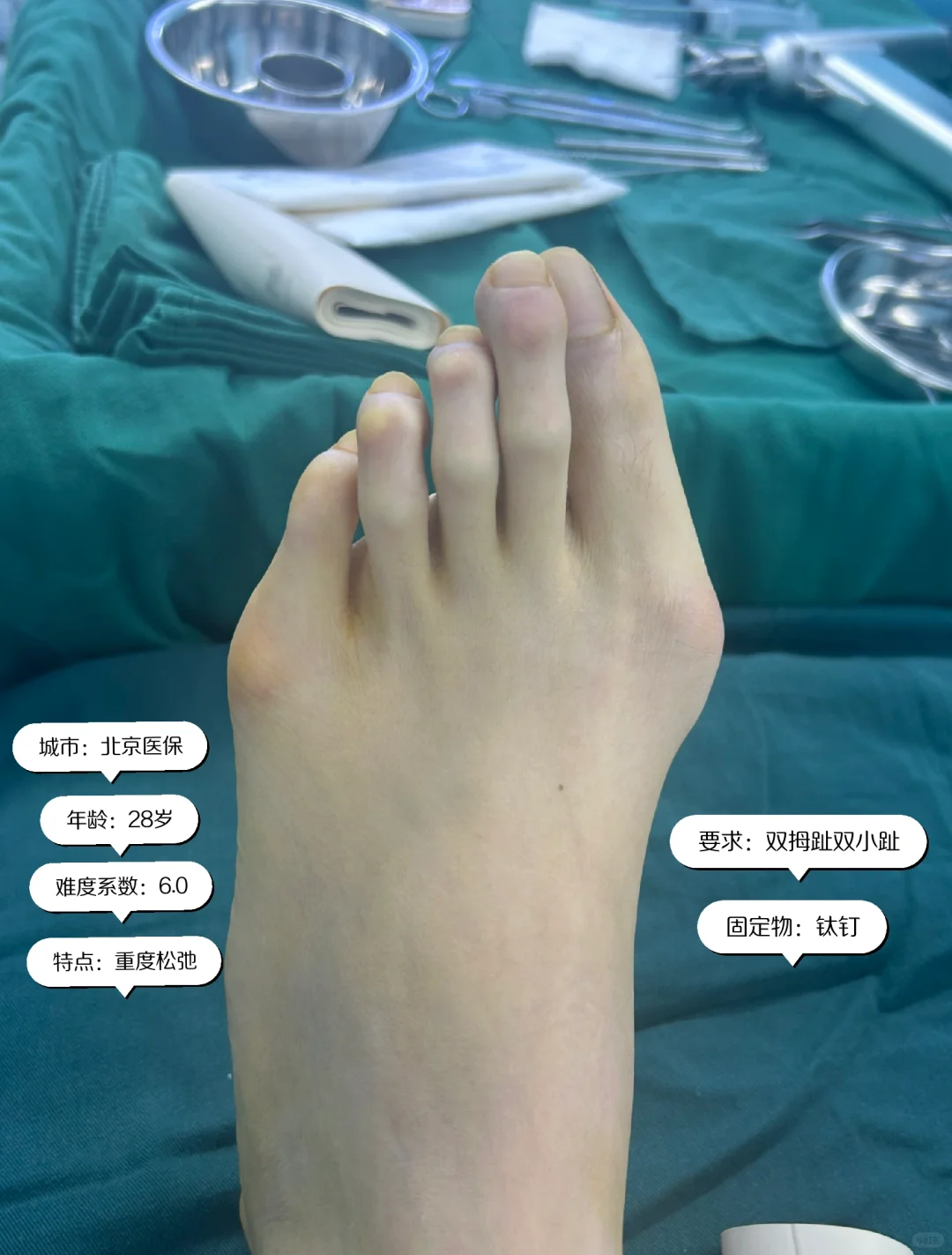周日只做了两台