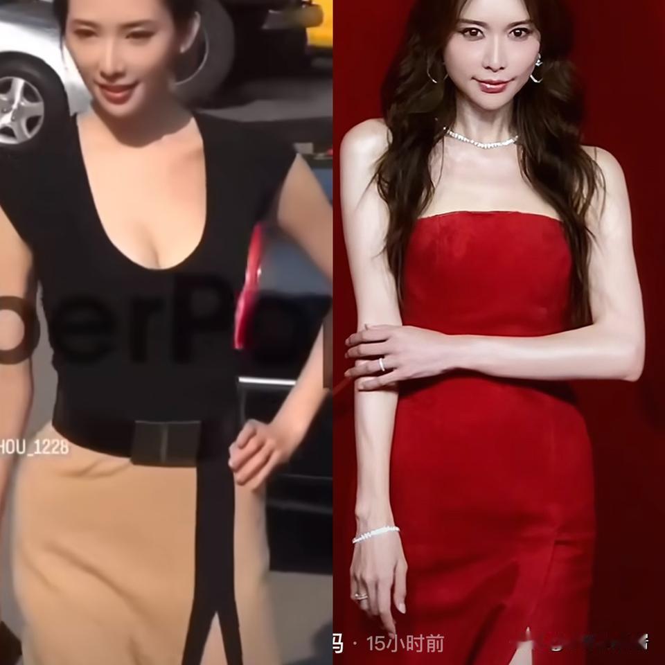 林志玲是真的被打的假体都重新修复了吗？
感觉面相跟以前不一样了，有点“夫妻相”了