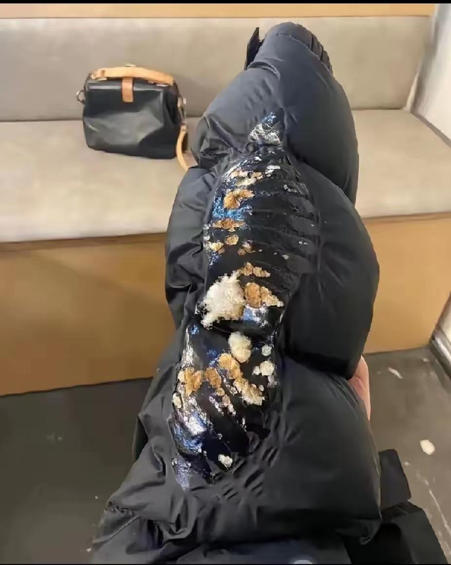 我的老天鹅啊！
谁来救救我！
花了一千多块买的羽绒服，烤个火就变成这样了，
我该