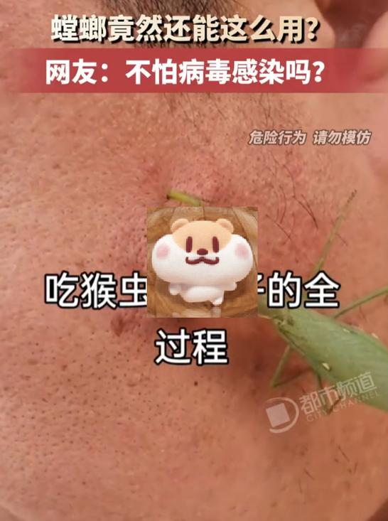 “头皮发麻！”8月10日消息，山西一名男子为去除脸上瘊子，找来螳螂放在脸上啃食疣