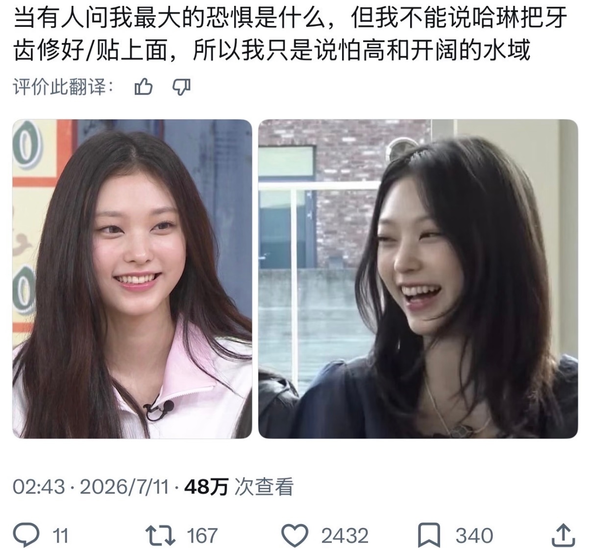 海粼的牙真的可惜了，本来只是下牙有一点小乱，原生的兔牙和虎牙很有辨识度很可爱，现